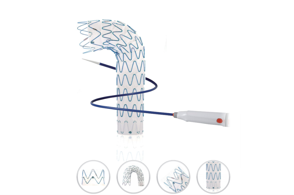China Thoracic Aortic Stent Graft System Innovations for Aortic Repair